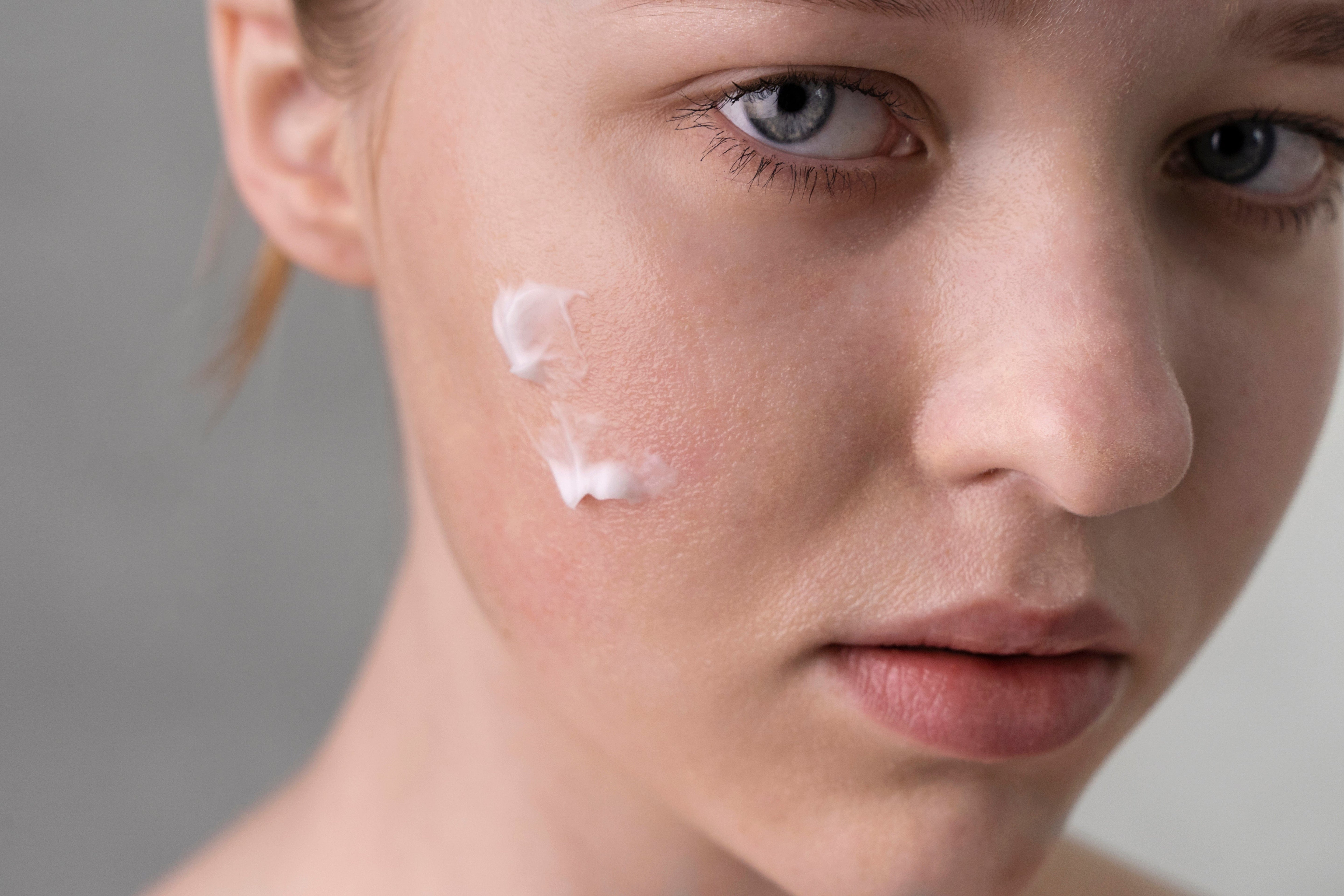 Dry Skin