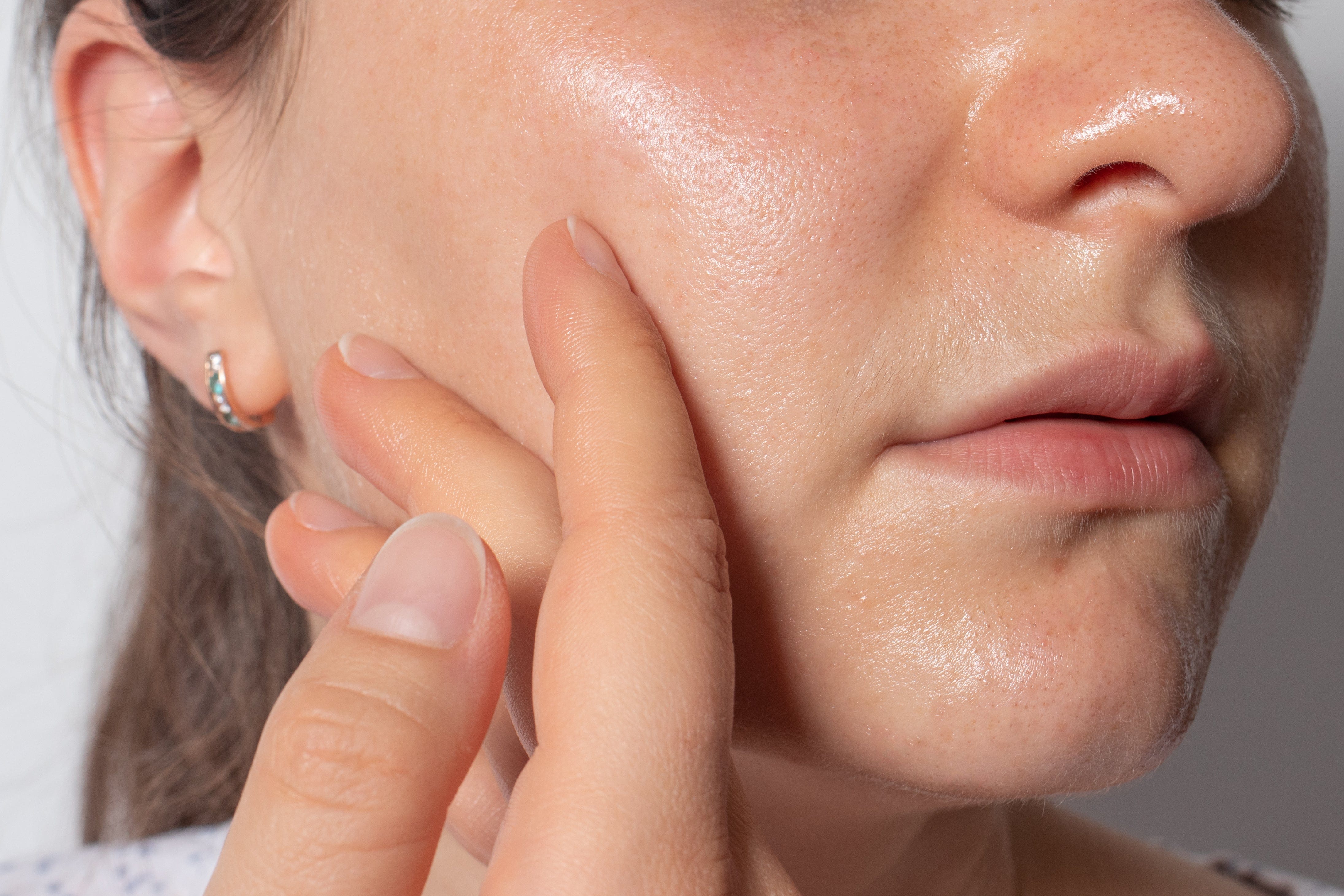 Oily Skin