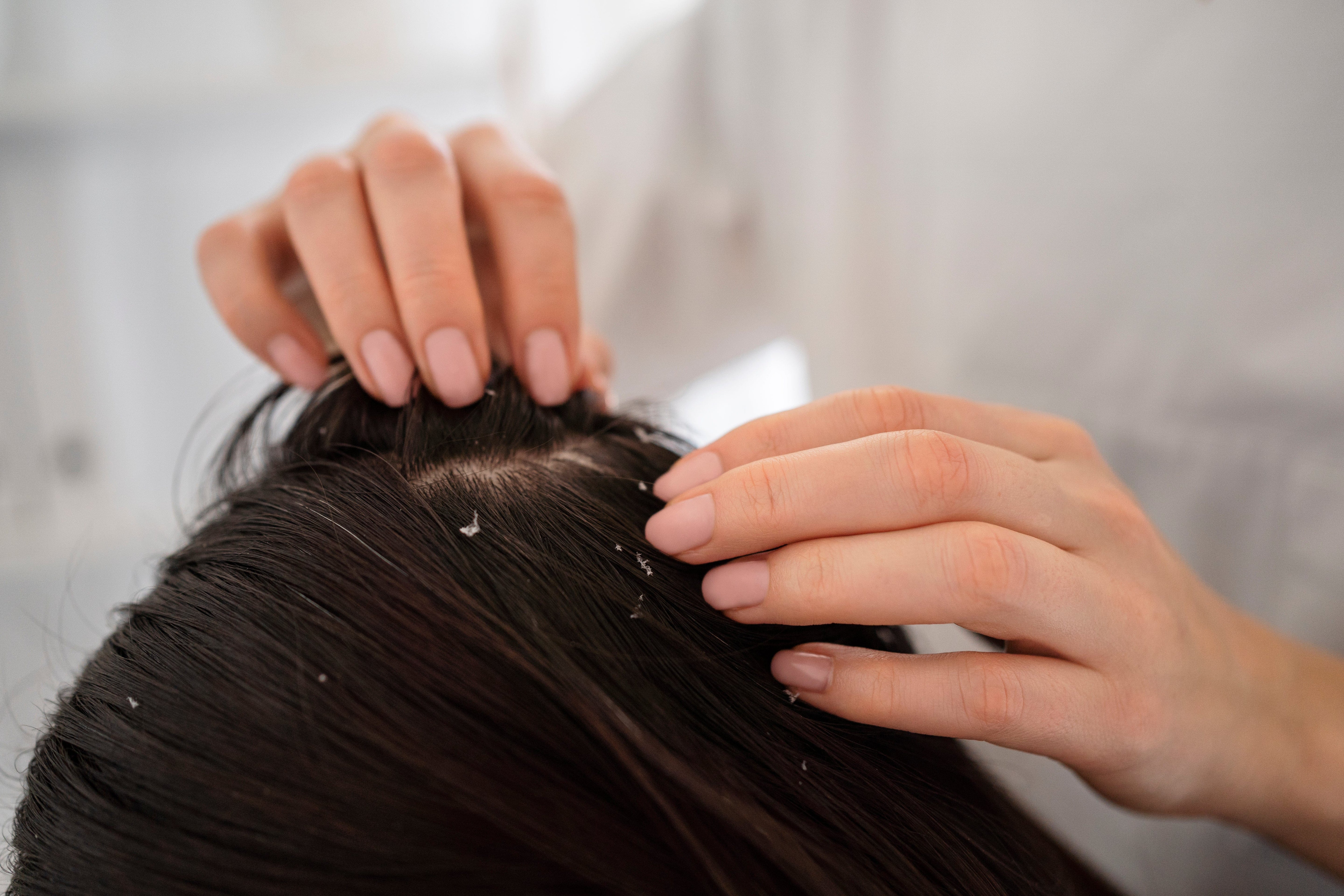 Anti-Dandruff for Oily Scalp