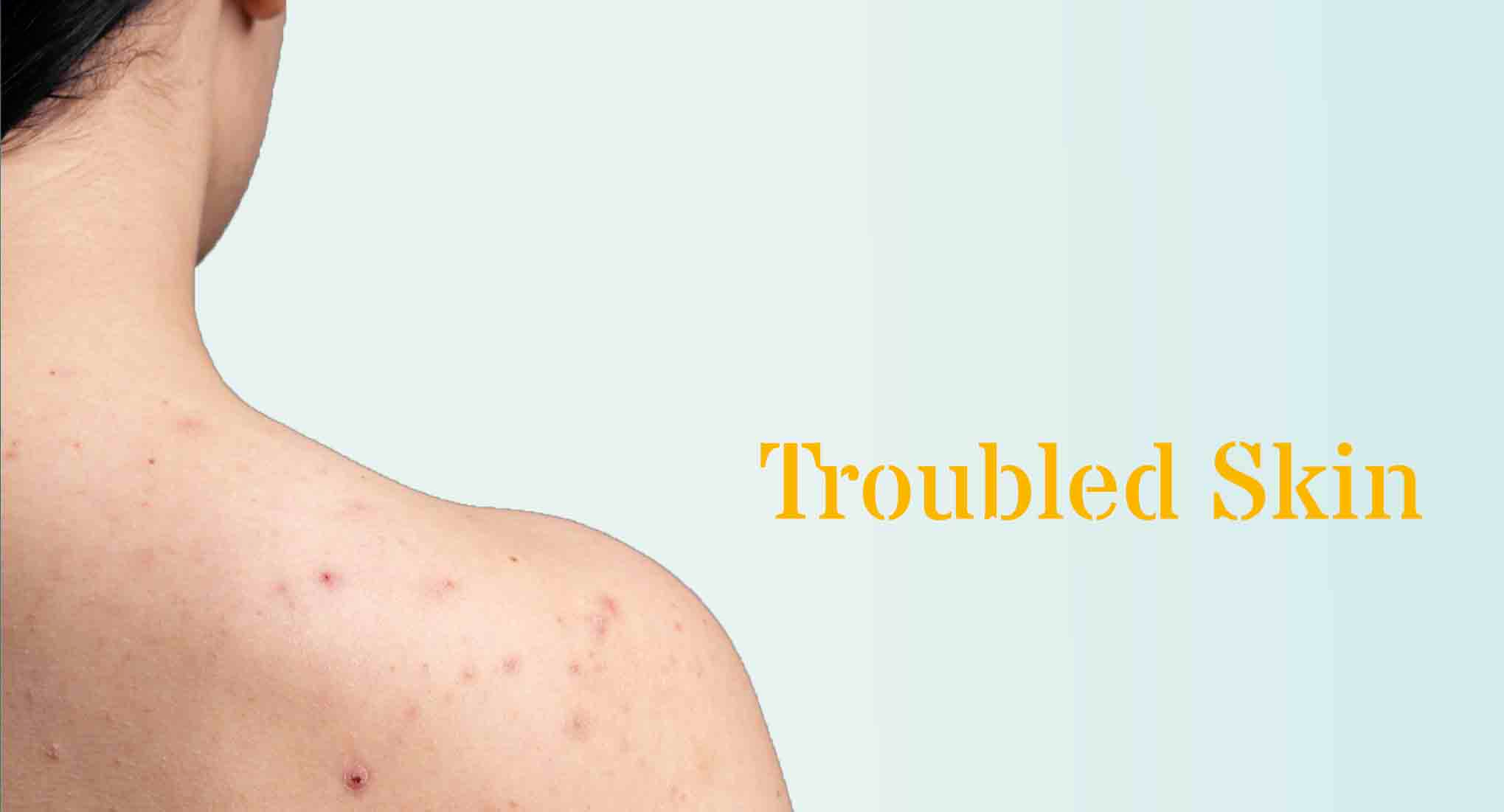 Body Care for Oily Skin